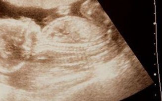 广东省人民医院试管婴儿费用清单