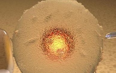 泰国拉拉试管婴儿机构哪家比较好？